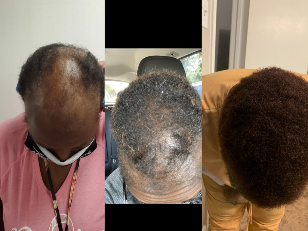 10 in 1 Hair Growth Oil (2oz.) Hair Growth Co