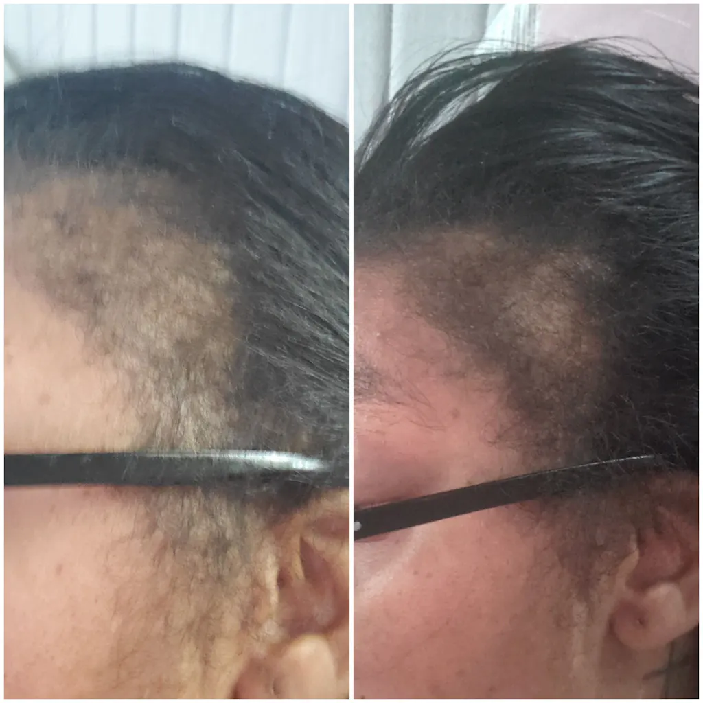 10 in 1 Hair Growth Oil (2oz.) Hair Growth Co