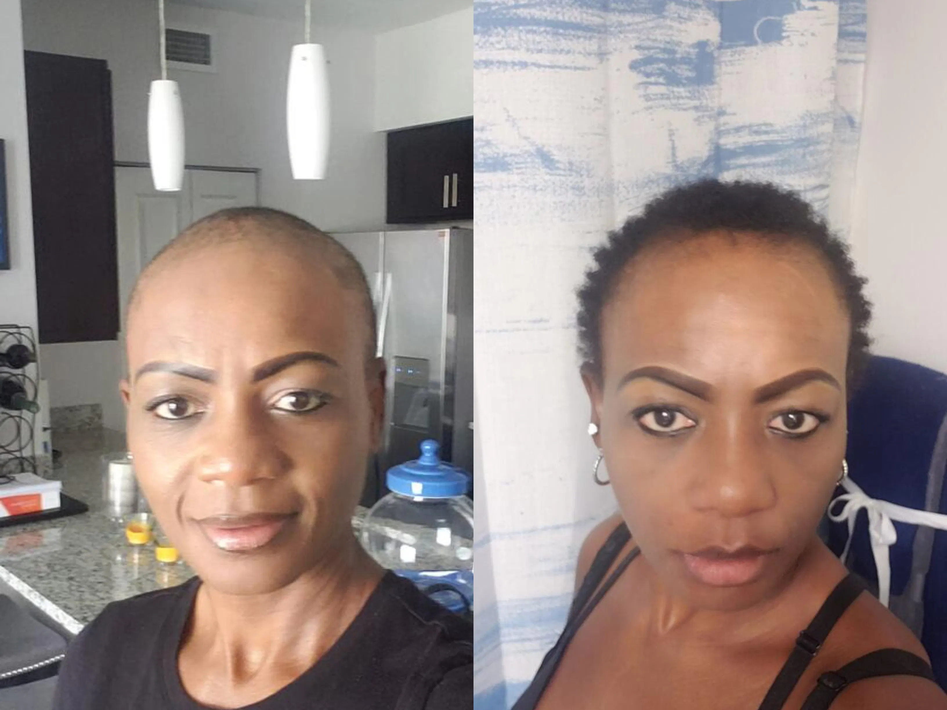 10 in 1 Hair Growth Oil (2oz.) Hair Growth Co