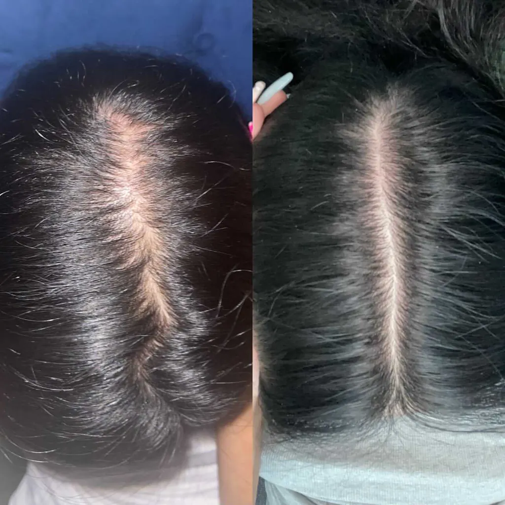 10 in 1 Hair Growth Oil (2oz.) Hair Growth Co