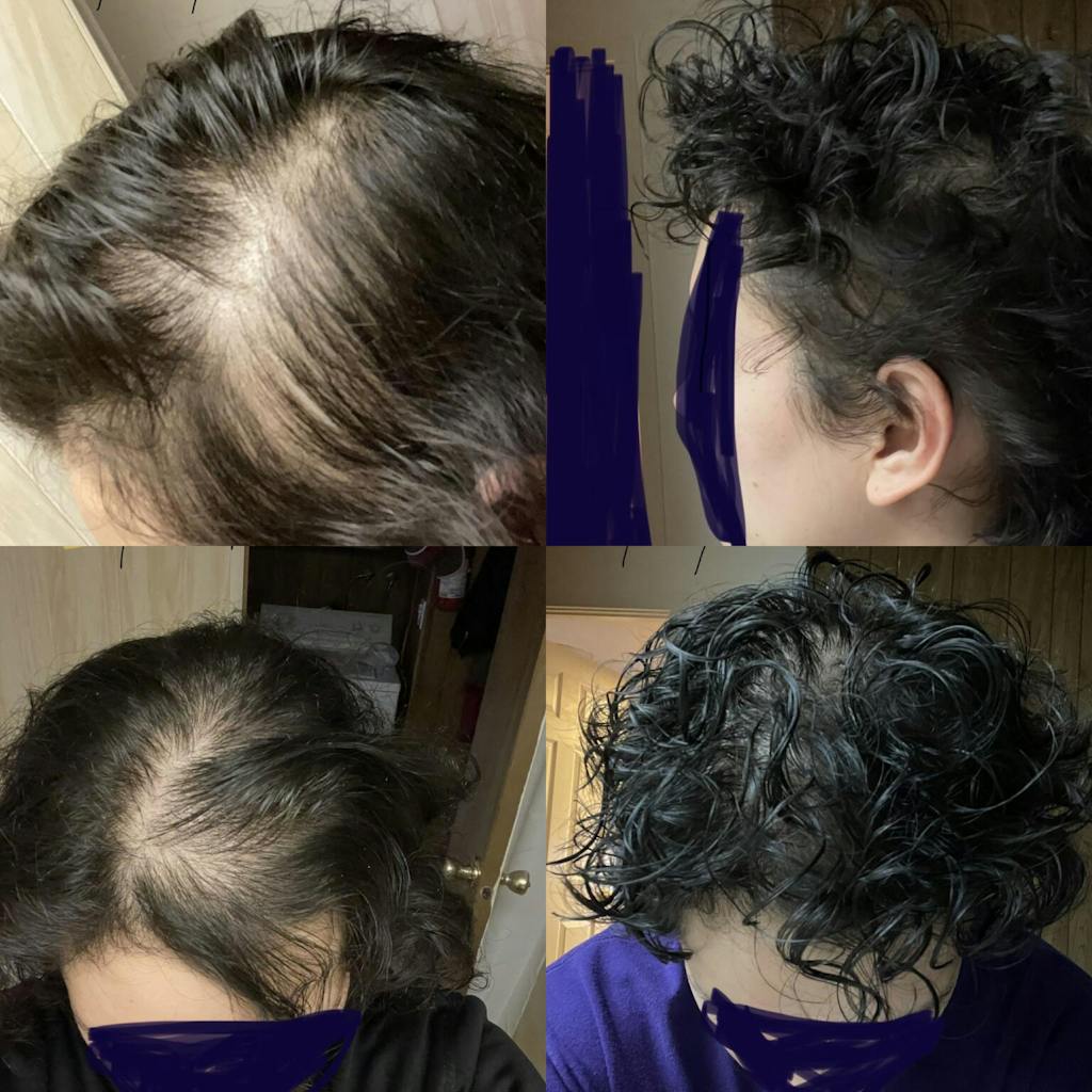 10 in 1 Hair Growth Oil (2oz.) Hair Growth Co