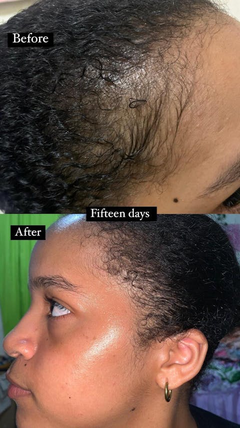 (10 in 1) Hair Growth Oil