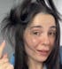 Hair Loss Treatment Set for Women