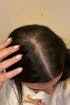 Hair Growth Oil
