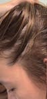 Hair Growth Oil