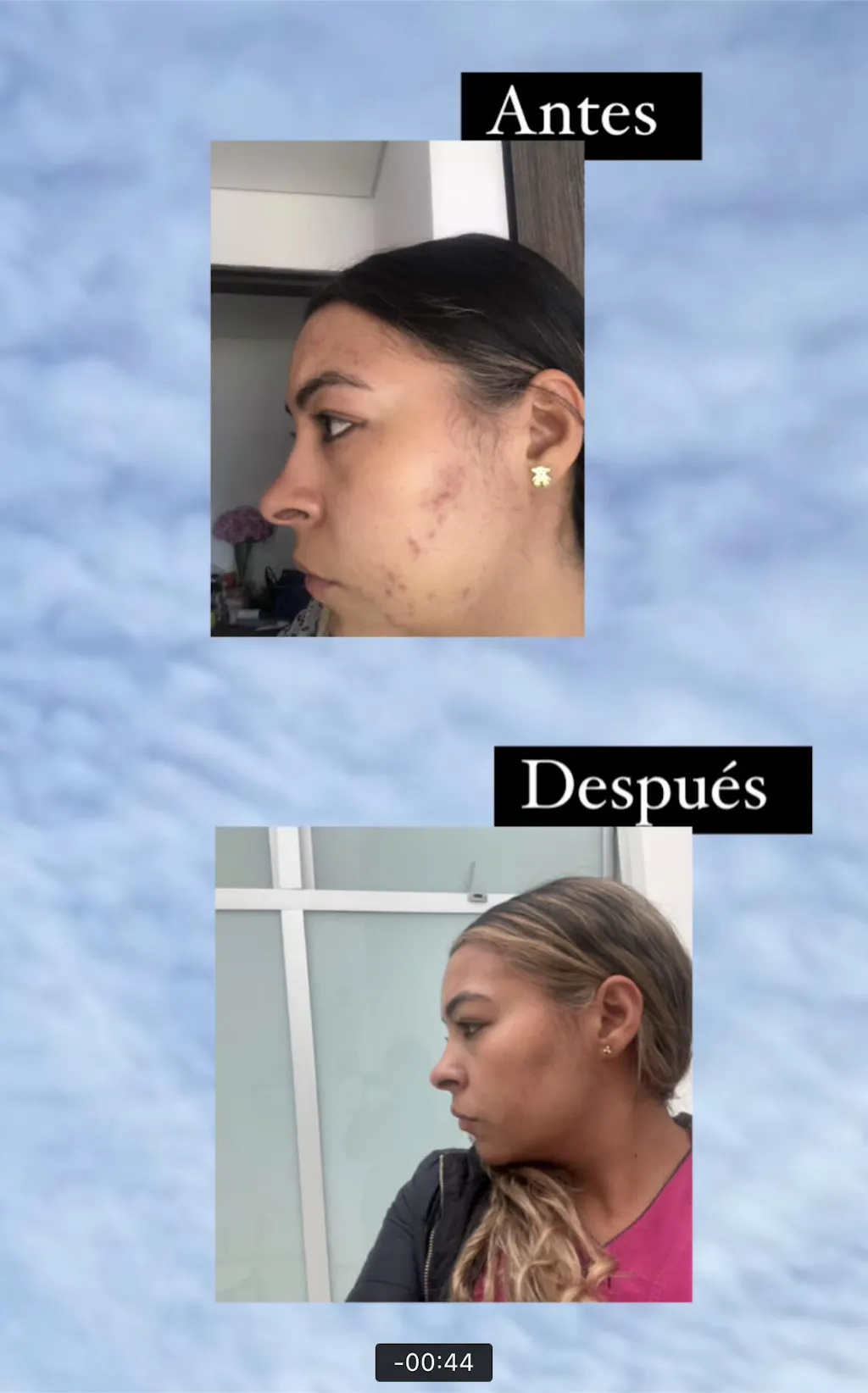 testimonios-harumi-belleza-coreana