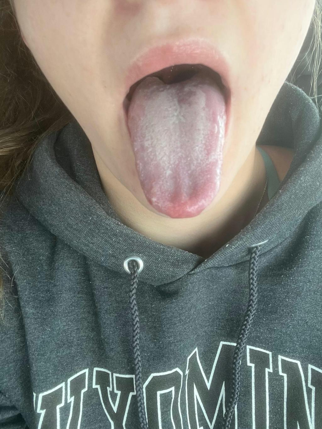 Digest & Detox Bundle