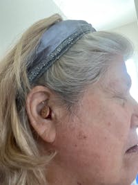 Micro CIC Rechargable Hearing Aids (Pair) Binaural