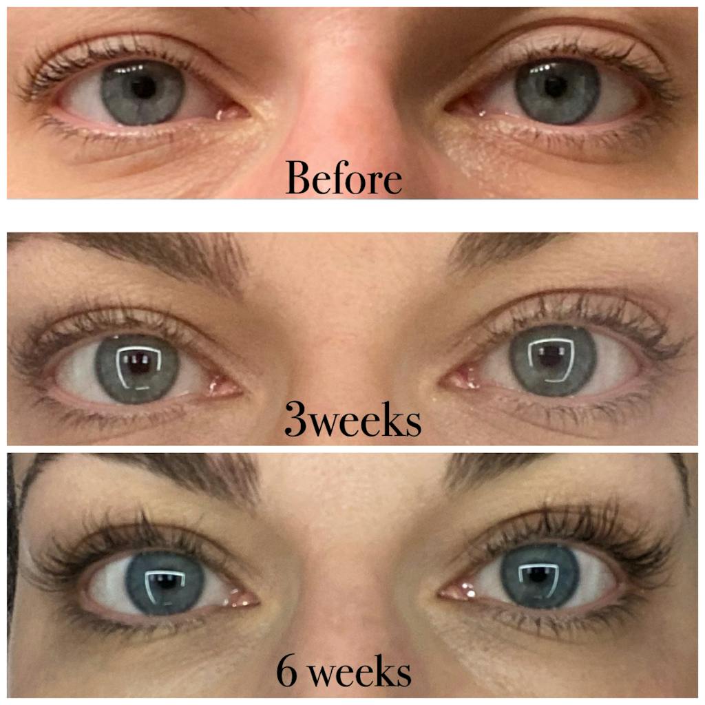 LASH THERAPY – Hello Skincare