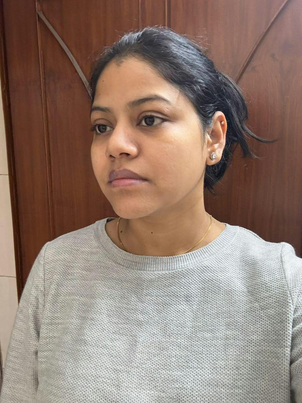 Herbalmax Marine Collagen With Hyaluronic Acid, Vitamin C & E, Biotin - for Youthful Skin (240 gm)