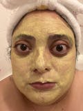 Turmeric Face Mask - Brightening & Detoxing Clay mask - Clears Dark spots & Acne