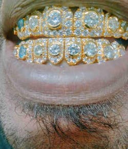 Honeymoon Set Round Cut Diamond Grillz