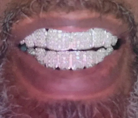 Custom Fully Iced Princess Cut Grillz