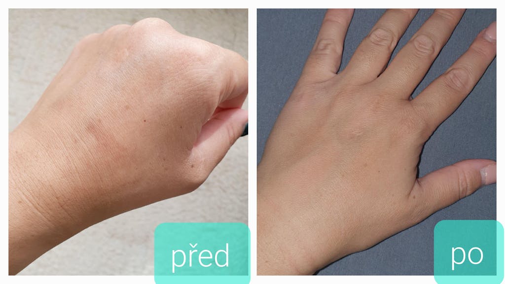 Organická voda z Jedle bělokoré - Hydrolina na Pigmentové skvrny