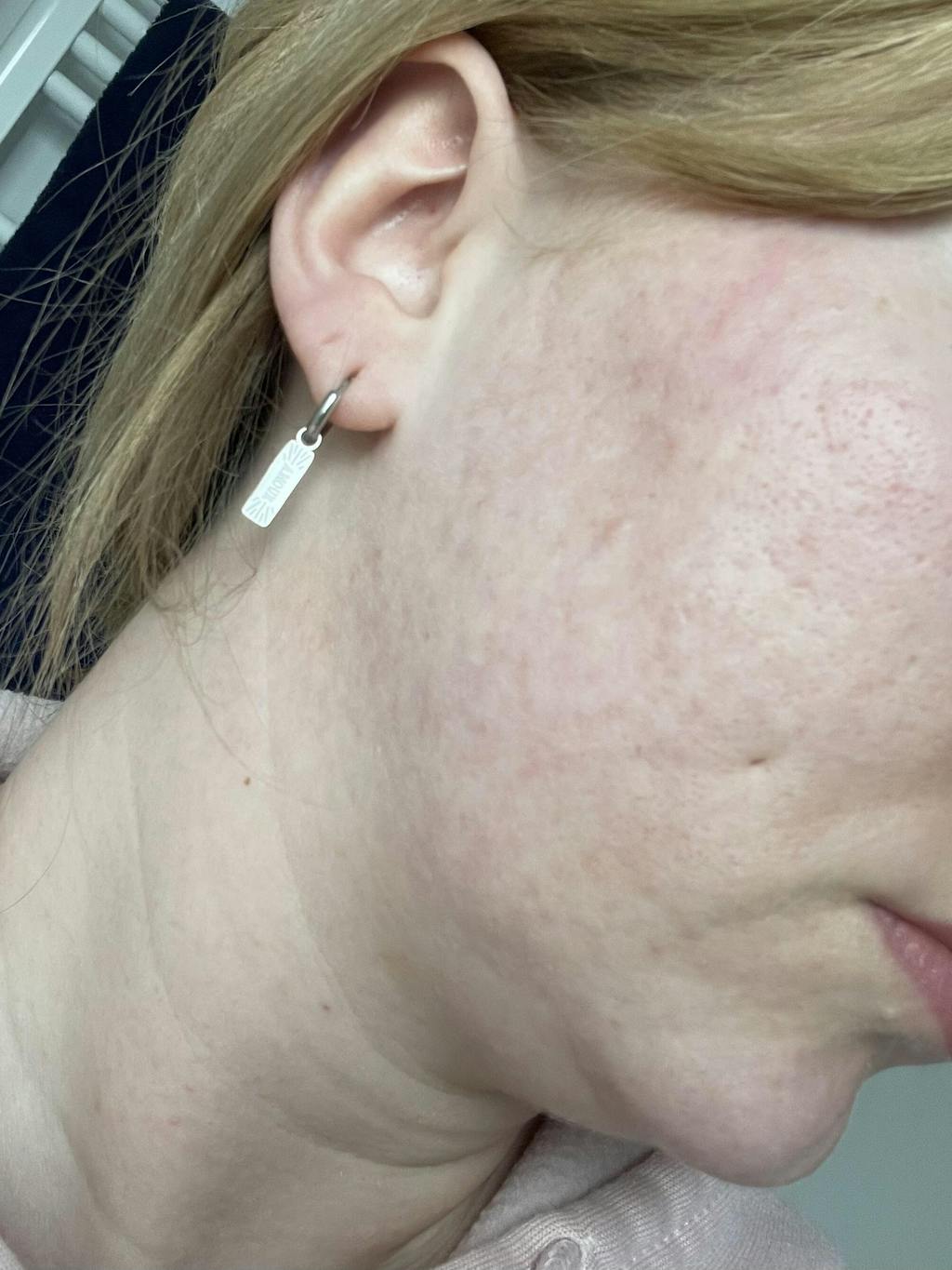 Hydrobiotic - Lavande & Menthe - soins intensifs pour l'Acné