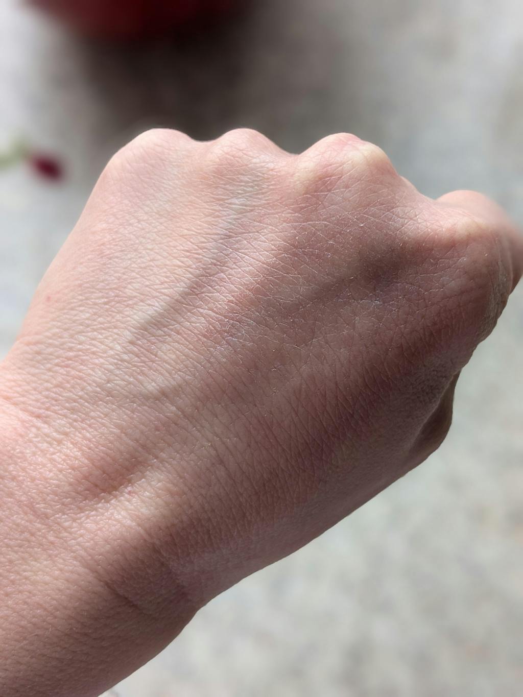 Krem na łuszczycę, egzemę i podrażnioną skórę - z dziurawcem, rumiankiem i propolisem