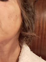 Água de Abeto Branco Orgânica - Hydrolina para Hiperpigmentação