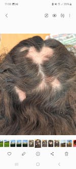 Champô Natural de Urtiga Selvagem para Queda de Cabelo