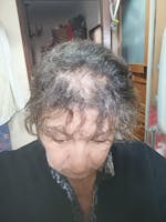 Champô Natural de Urtiga Selvagem para Queda de Cabelo