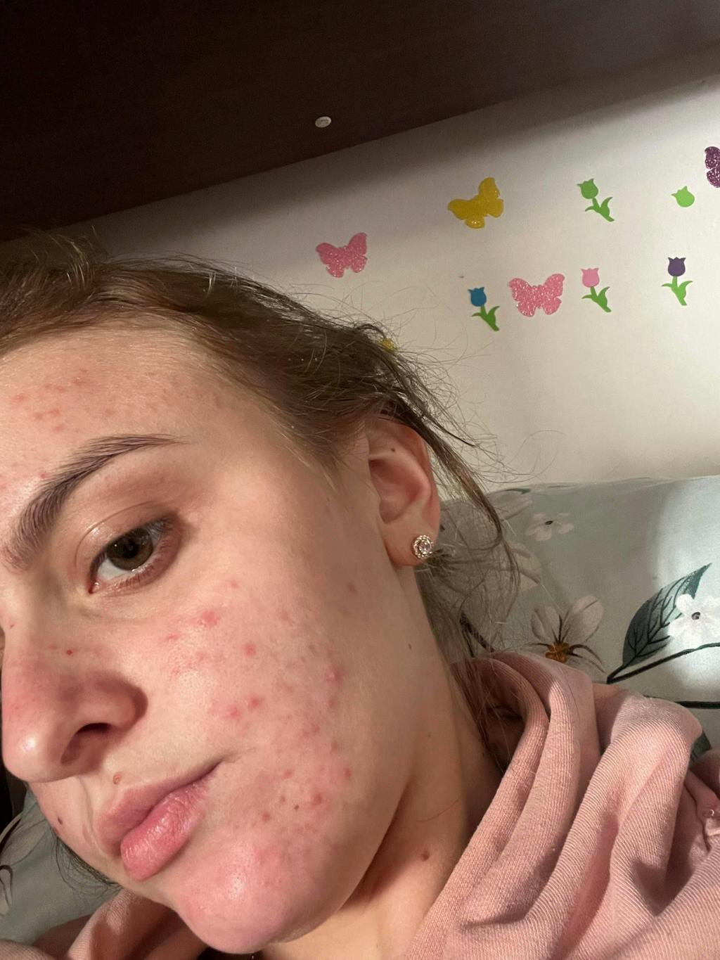 Apă Organică de Lavanda - Hydrolina - pentru Acnee