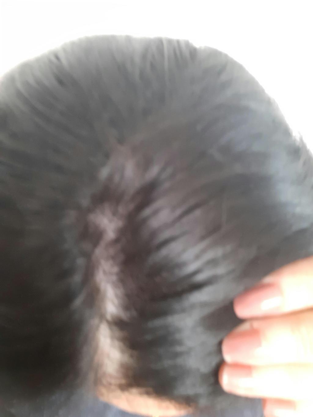 Protiv peruti RoutINA™ za Njega - trajno rešenje za Perut i Seboreju