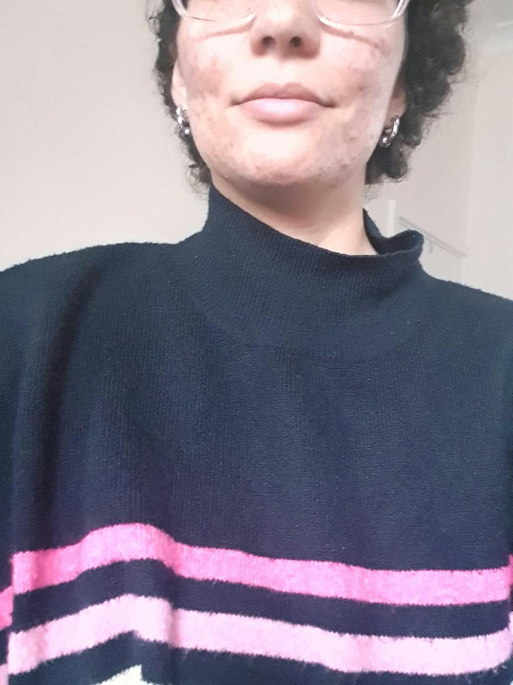 Organic Lavender water - Hydrolina for Acne