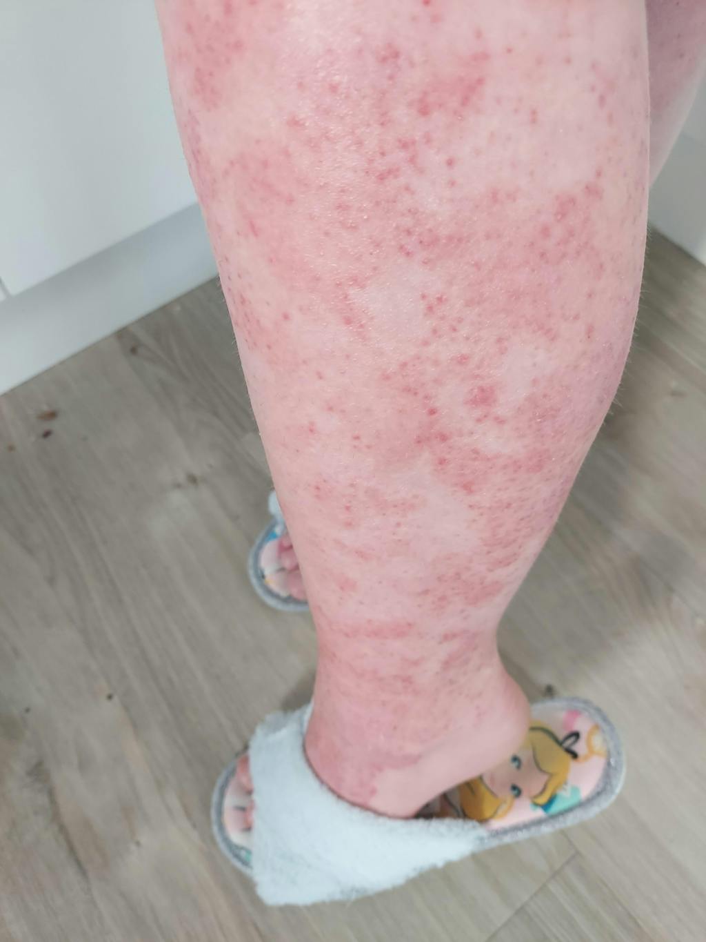 Organic Chamomile water - Hydrolina for Eczema and Irritated skin