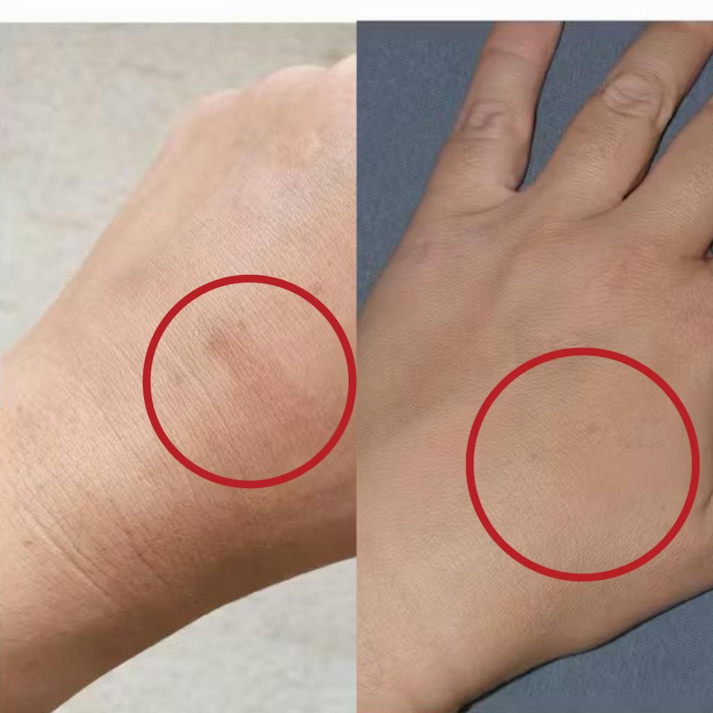 Organic White Fir water - Hydrolina for Pigmentation