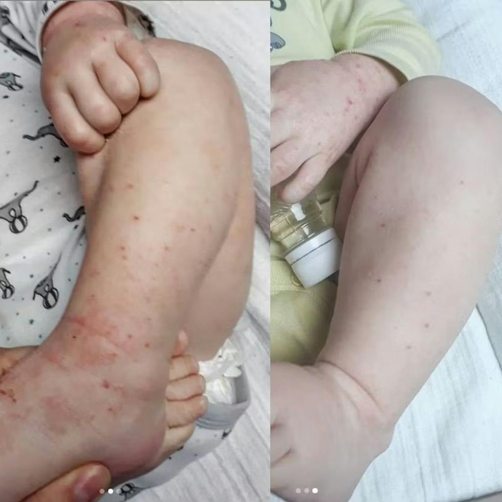 Organic Chamomile water - Hydrolina for Eczema and Irritated skin