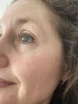 Bakuchiol Ultimate Anti-Aging Set