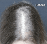 Hair Fall Serum Organic (100% Ayush Ministry Certified) - For Hair Fall Control, Reduced Hair Loss & Baldness (Both Men & Women)