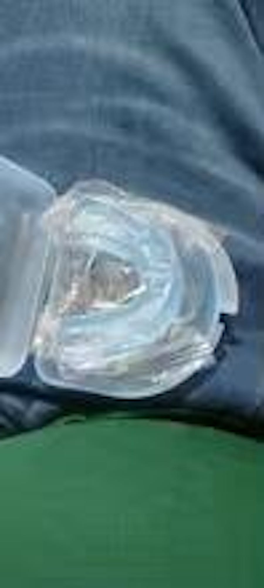 Protège-Dents Anti-Ronflement et Anti-Bruxisme