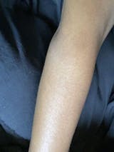 Regular Eczema Support Bundle