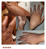 Eczema Relief Body Oil