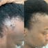 BLÜOM Hair & Scalp Oil for Hair Thinning, Bald Spots & Edges