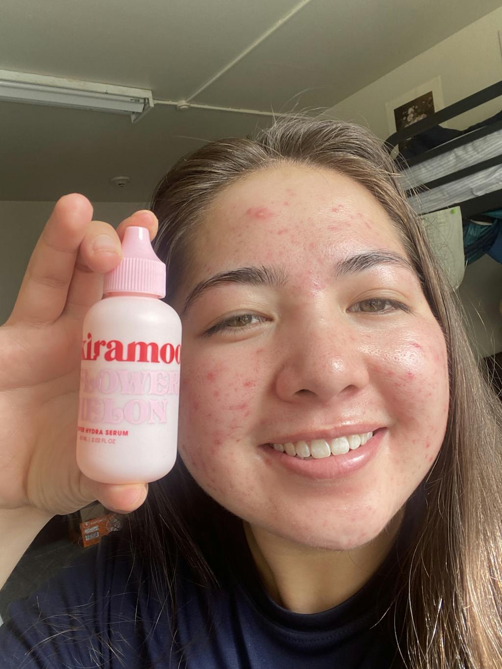 Flowermelon Super Hydrating Serum 💦🧪 Kiramoon