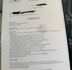 Review picture