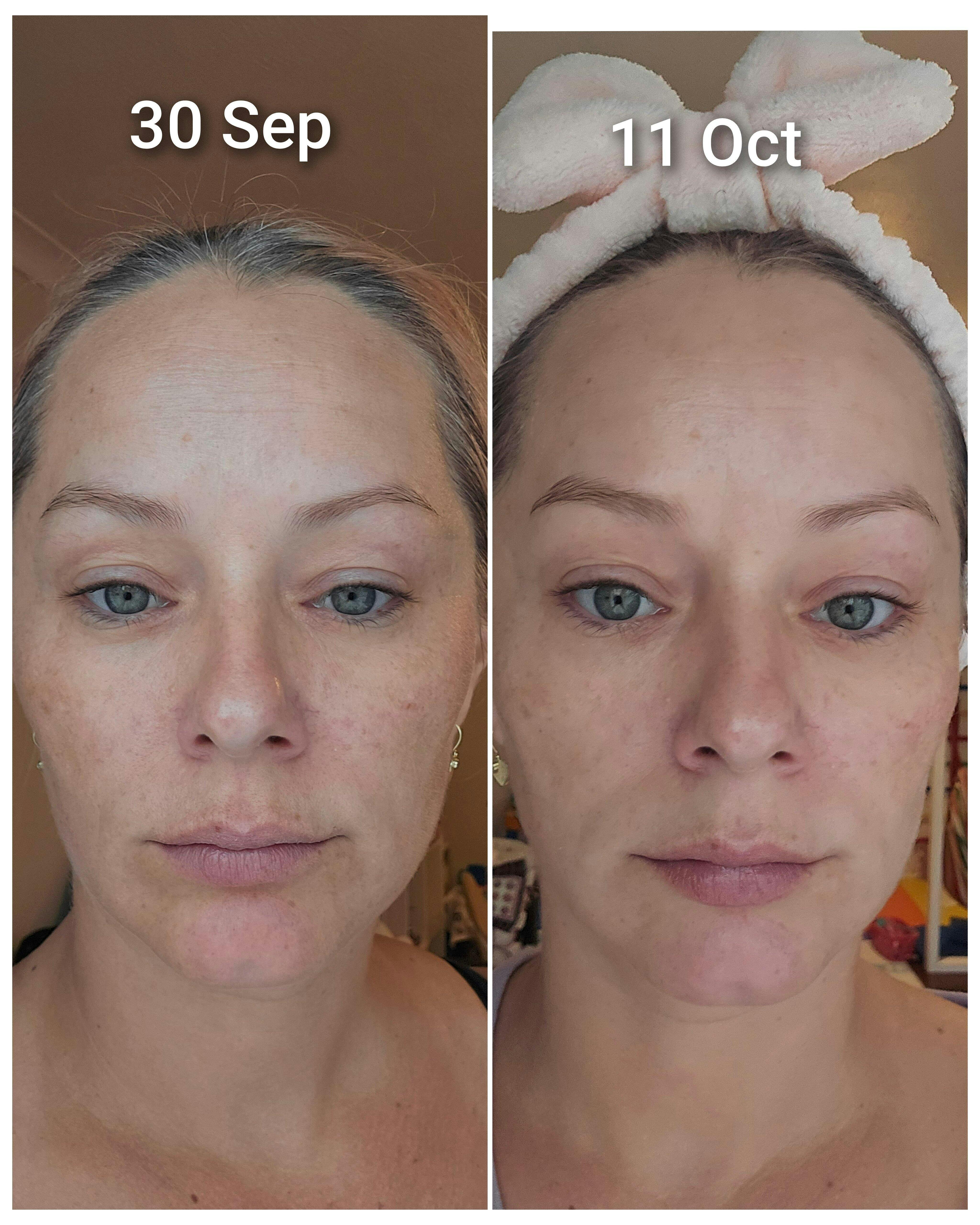 Haruharu WONDER Black Rice Hyaluronic Cream – Korean-Skincare