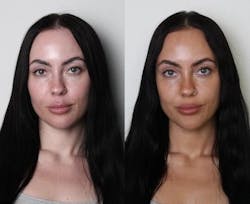 Természetes Önbarnító Cseppek