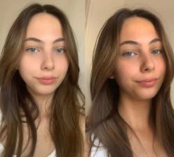 Természetes Önbarnító Cseppek