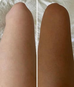 Természetes Önbarnító Cseppek