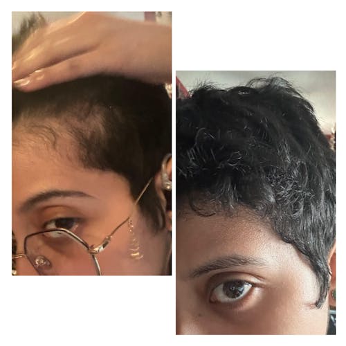 La Si Mauri Hair Growth Serum