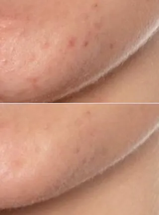 Daily Vitamin C Serum