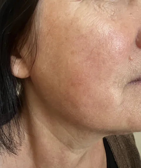 ELIXIR KLASIK - pomlajevalna krema (50 ml)