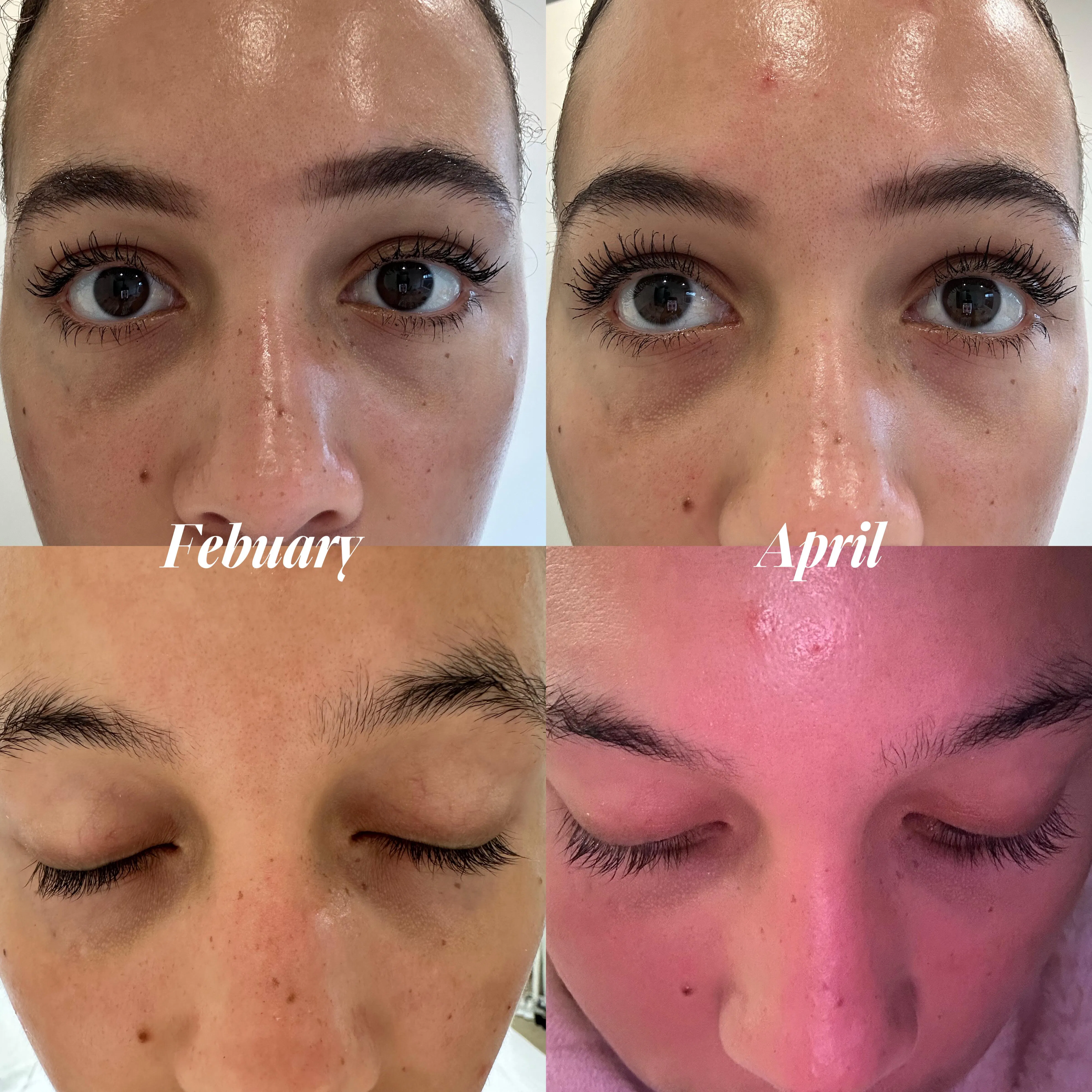 Ultimate Lash Bundle Lash Therapy Australia