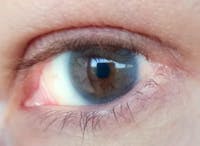 Aileen [ BLUE ] 1 Month