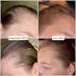 Hair Growth Serum 30ml