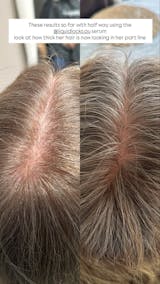 Hair Growth Serum 30ml