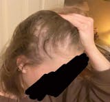 Hair Growth Serum 30ml