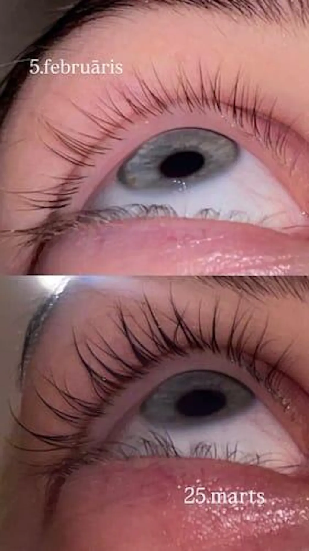 Skropstu Augšanas Serums